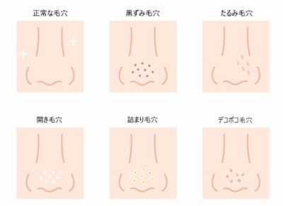毛穴スキンケア